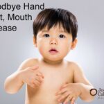 Hand, Foot and Mouth Disease