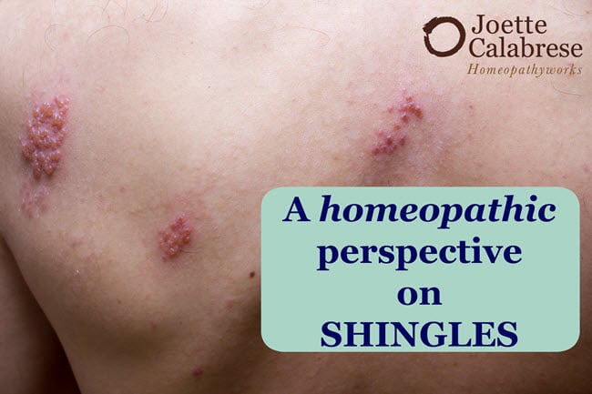 homeopathic-perspective-on-shingles-edited