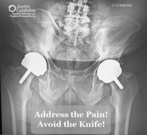 Address the Pain! Avoid the Knife! - JoetteCalabrese.com