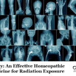 <i>X-Ray</i>: An Effective Homeopathic Medicine for Radiation Exposure