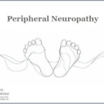 Peripheral Neuropathy: 2 Homeopathic Medicines for The Agony of ‘Da Feet'