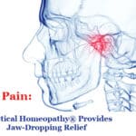 Dolor de ATM: la homeopatía práctica® proporciona un alivio asombroso
