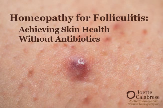 Joette Calabres, Practical Homeopathy®, Homeopathy for Folliculitis: Achieving Skin Health Without Antibiotics
