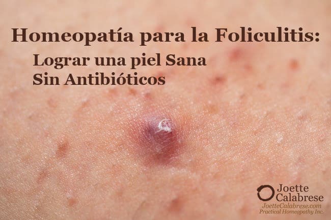 Joette Calabrese, Homeopatía Práctica®, Homeopatía para la foliculitis: Cómo lograr una piel sana sin antibióticos